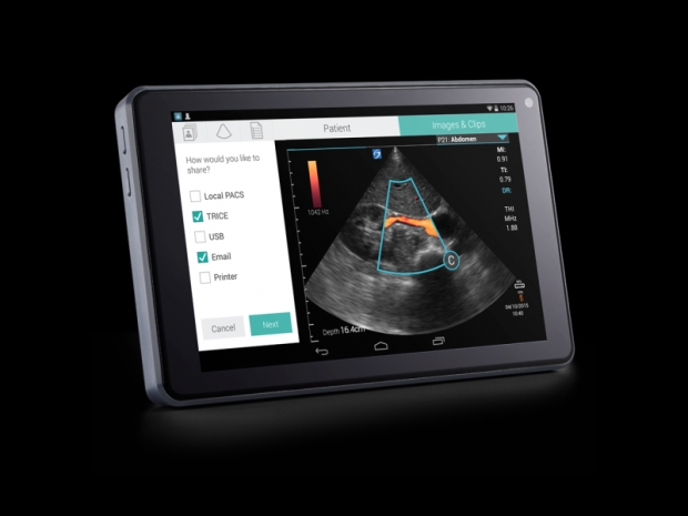 The iViz Snapdragon 600 ultrasound tablet saves lives